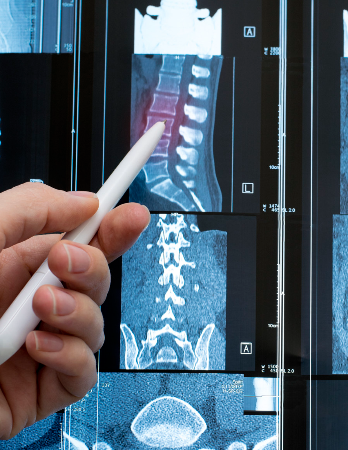 Banner-escritorio-medicina y cirugia de columna-v2.png