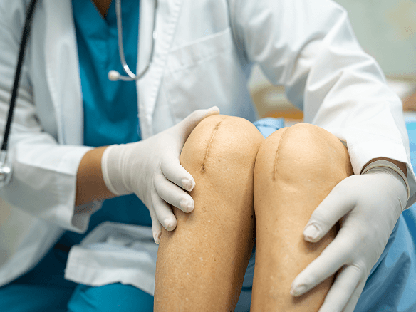 im1-medicina y Cirugía de rodilla.png